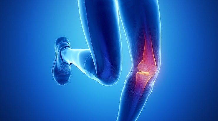 Read more about the article ACL: Mengenal Cedera Ligamen Lutut Anterior Cruciate dan Proses Pemulihannya